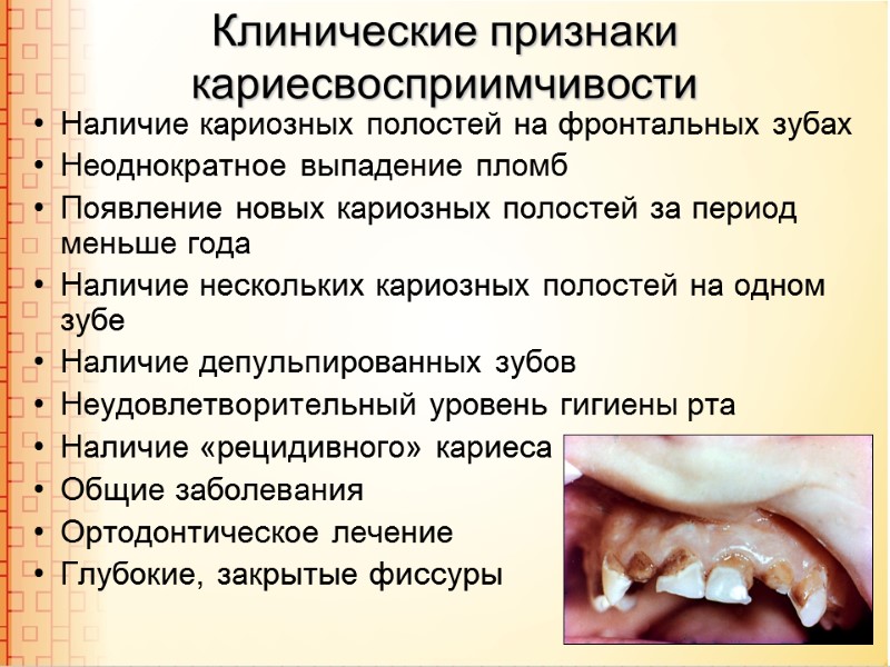 Клинические признаки кариесвосприимчивости Наличие кариозных полостей на фронтальных зубах Неоднократное выпадение пломб Появление новых